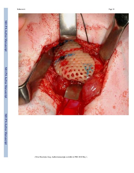 File:Lindig-HistochemCellBiol2009-fig6.pdf