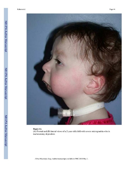 File:Lindig-HistochemCellBiol2009-fig6.pdf
