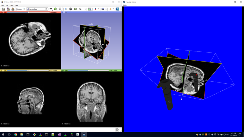 File:SlicerVirtualReality Screenshot2.png