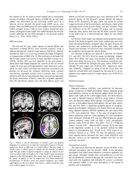 File:Yamasue-Neuroimage2004.pdf