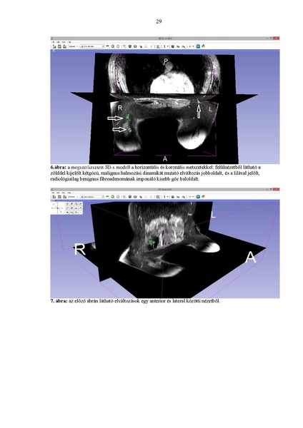 File:Meszaros-Thesis2015.pdf