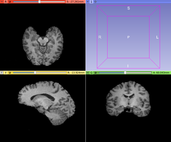 File:BrainMRI.png