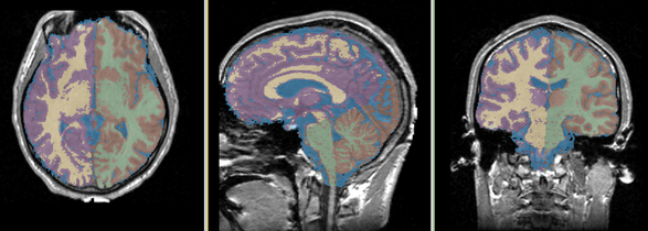 EMS Hemisphere labelmap50.png