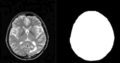 Thumbnail for version as of 16:14, 2 August 2007