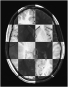 Registration BRAINSfit.png