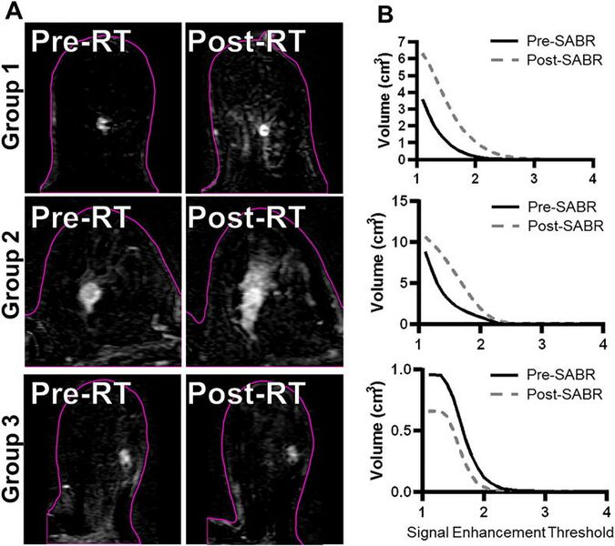 File:Mouawad-Clin Transl Radiat Oncol. 2019-fig2.jpg