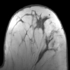 RegLib 06: Breast MRI