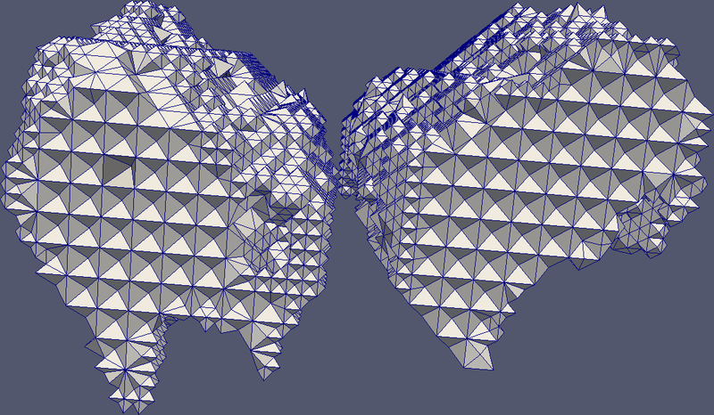 File:Ventricles section.jpg