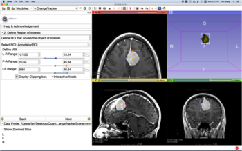 QuantitaiveImaging tutorial.png