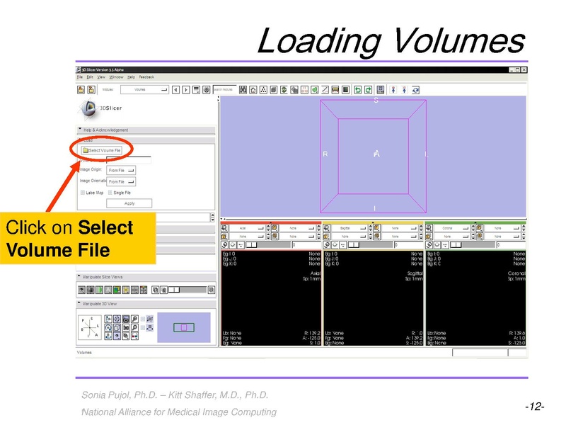 File:3DVisualizationLiverSegments SoniaPujol RSNA2009.pdf