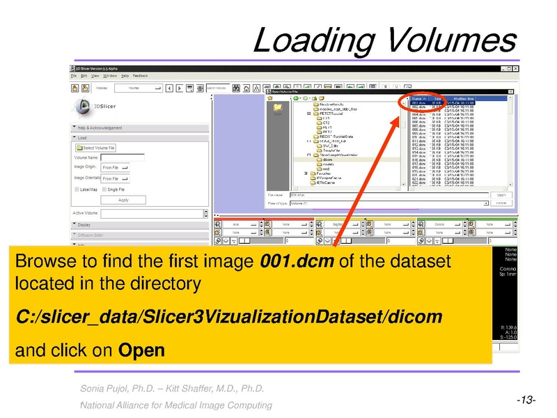 File:3DVisualizationLiverSegments SoniaPujol RSNA2009.pdf
