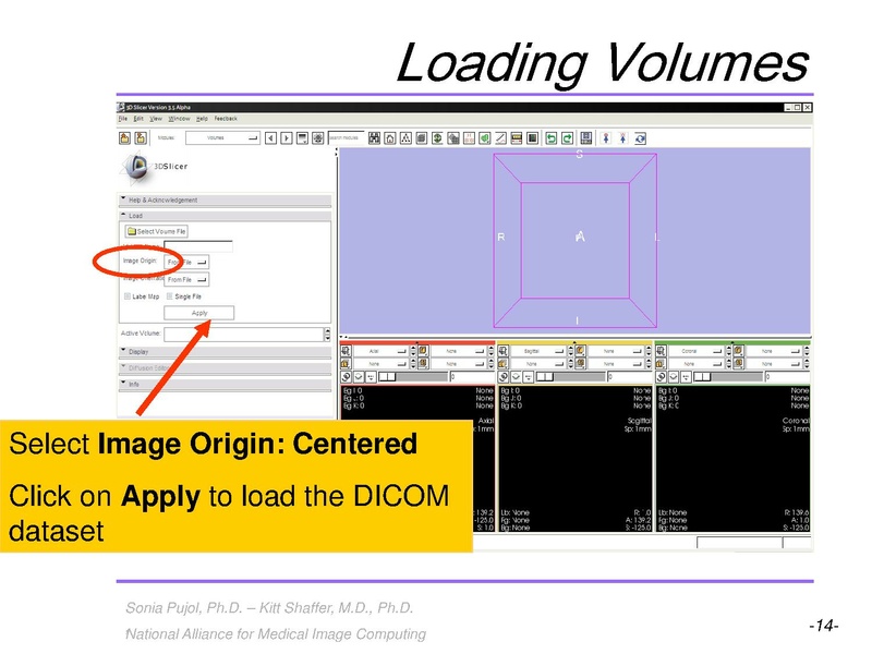 File:3DVisualizationLiverSegments SoniaPujol RSNA2009.pdf