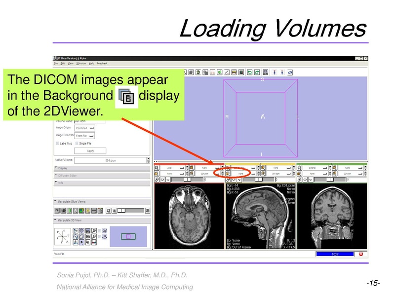 File:3DVisualizationLiverSegments SoniaPujol RSNA2009.pdf