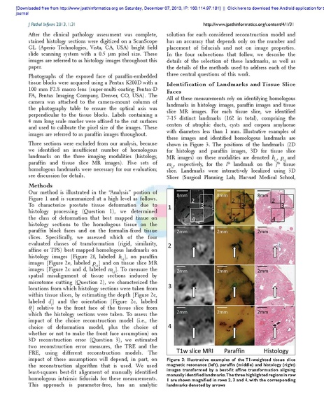 File:Gibson-JPatholInform2013.pdf