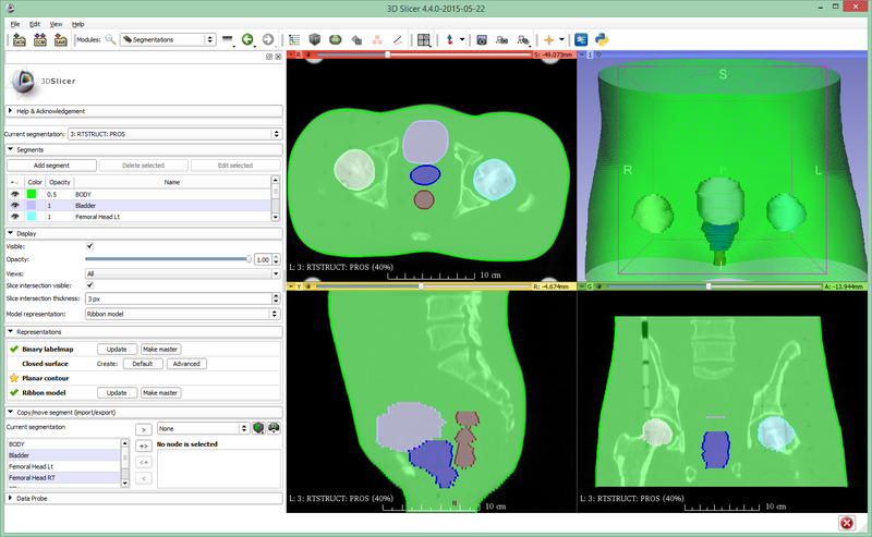 File:20150529 Segmentations.png