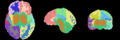 MRI-Human-Brain-Parcellation 3x360x360.png