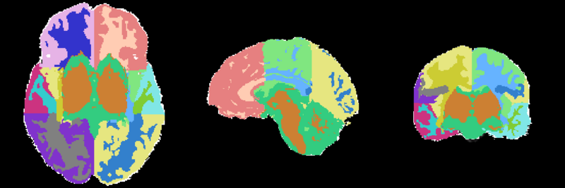 File:MRI-Human-Brain-Parcellation 3x360x360.png