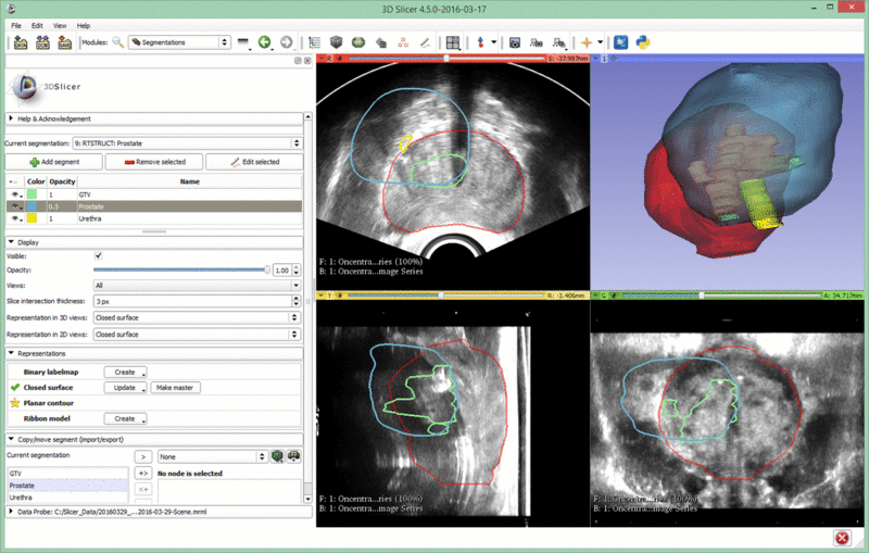 File:20160329 MRIUS 1500.gif