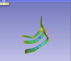 Fiber tracts in the Slicer 3D View