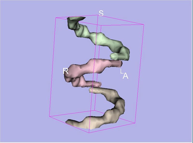 File:Slicer3.6ModelMakerOutput.jpg