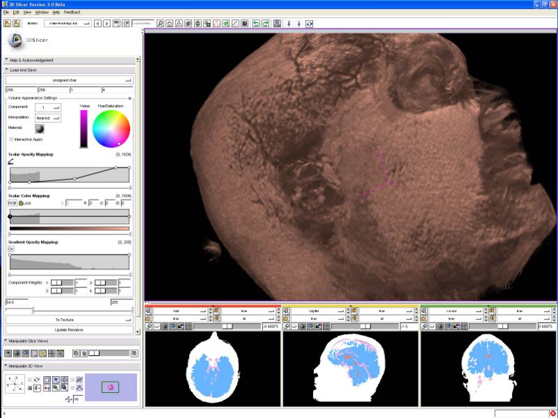 File:Slicer CudaHead.jpg