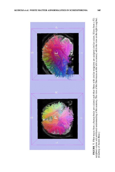 File:Kubicki 2005NYAS.pdf