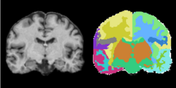 MRIHumanBrainParcellation.png
