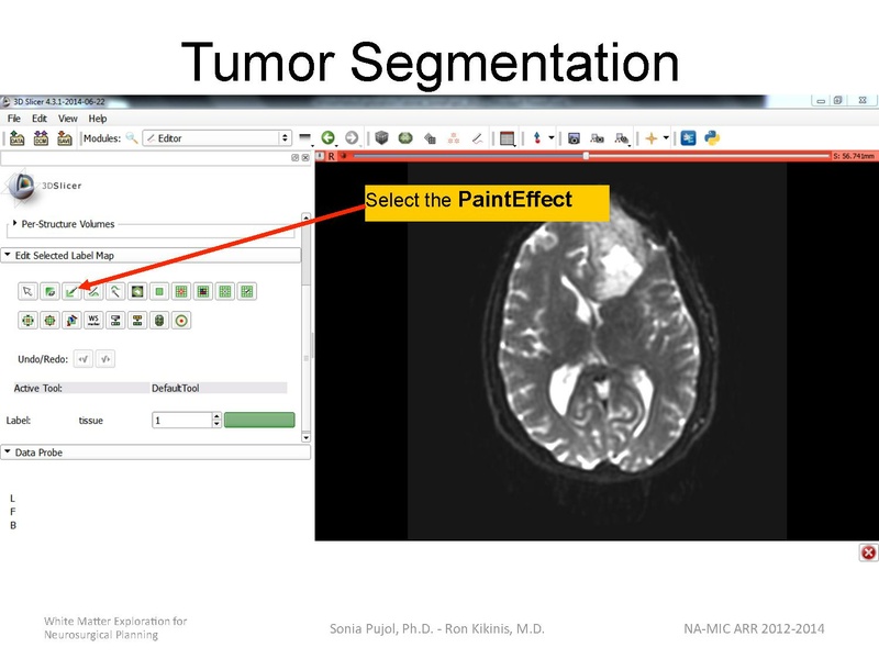File:WhiteMatterExplorationTutorial SoniaPujol 2014.pdf