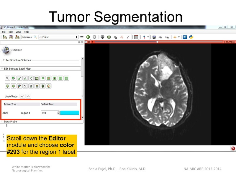 File:WhiteMatterExplorationTutorial SoniaPujol 2014.pdf