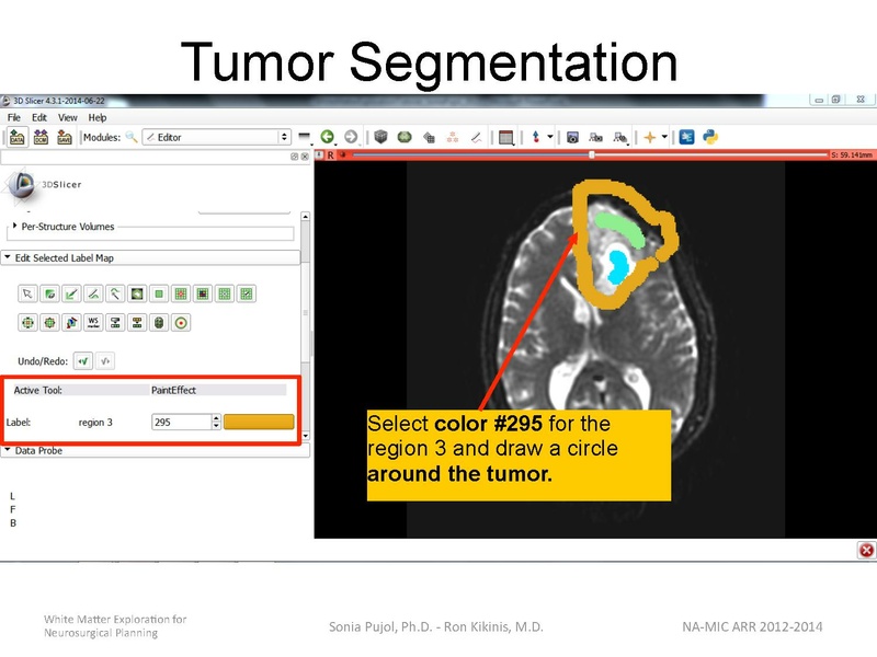File:WhiteMatterExplorationTutorial SoniaPujol 2014.pdf