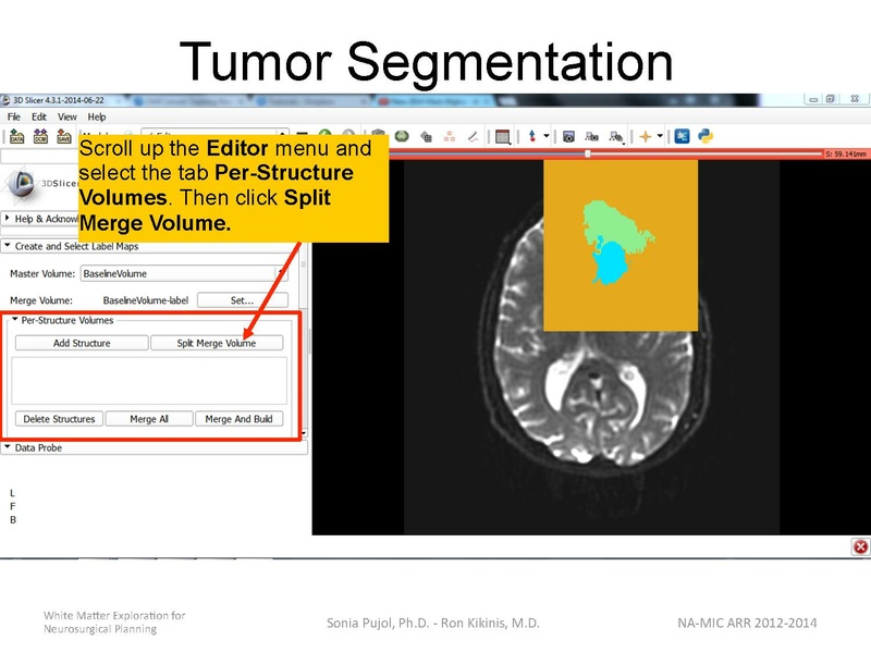 File:WhiteMatterExplorationTutorial SoniaPujol 2014.pdf