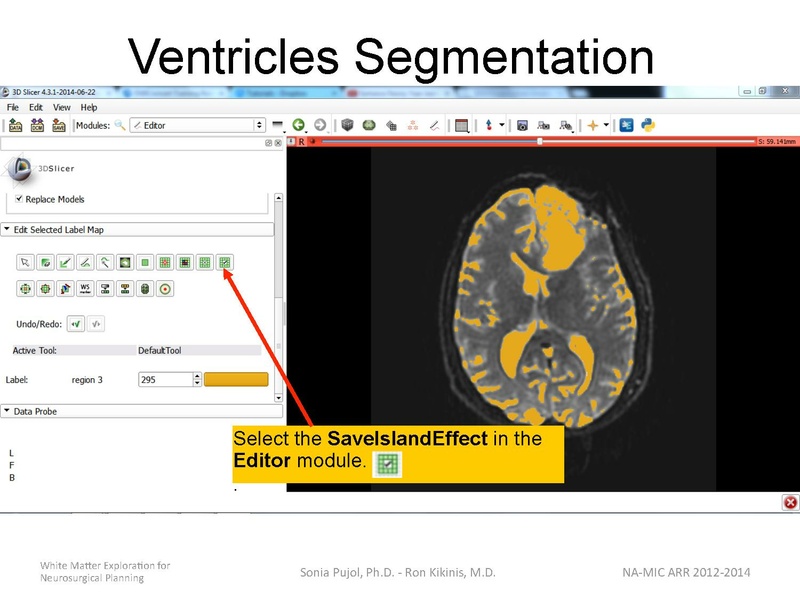 File:WhiteMatterExplorationTutorial SoniaPujol 2014.pdf