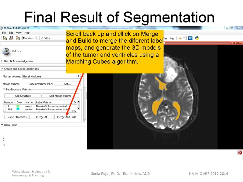 File:WhiteMatterExplorationTutorial SoniaPujol 2014.pdf