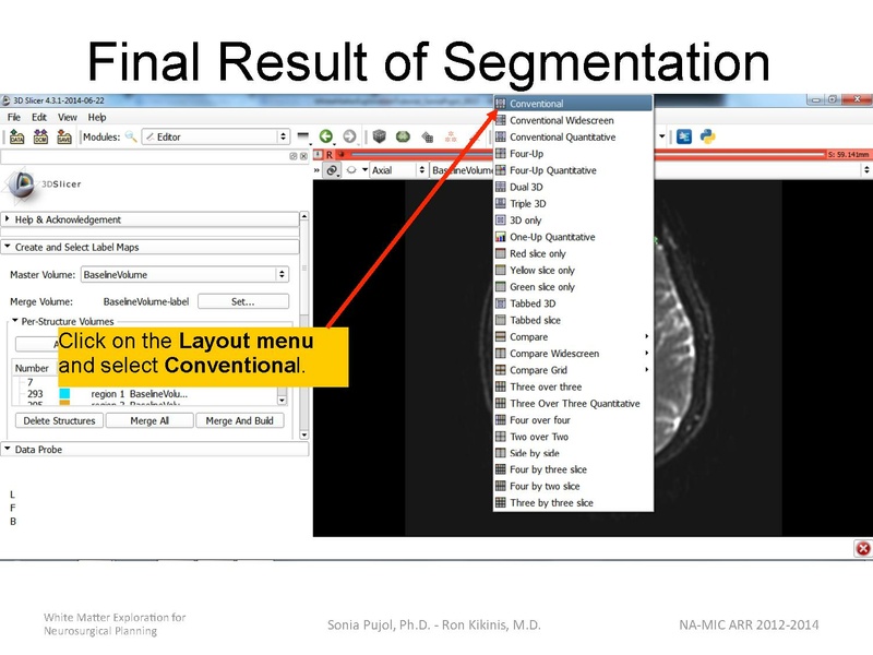 File:WhiteMatterExplorationTutorial SoniaPujol 2014.pdf