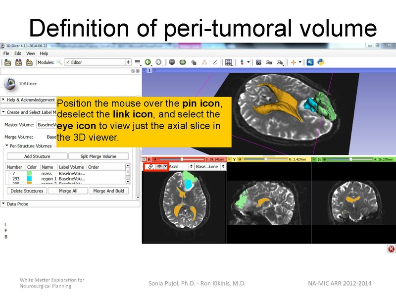 File:WhiteMatterExplorationTutorial SoniaPujol 2014.pdf