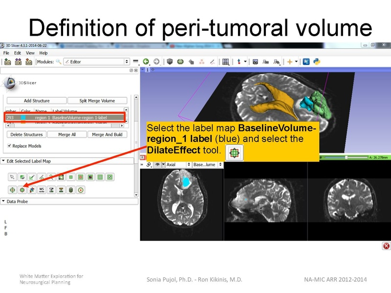 File:WhiteMatterExplorationTutorial SoniaPujol 2014.pdf