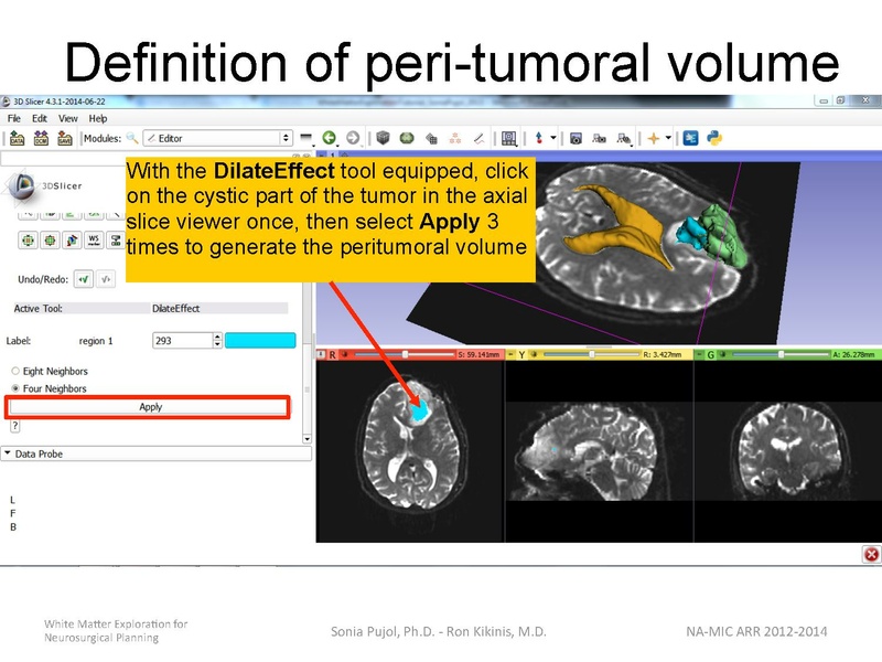 File:WhiteMatterExplorationTutorial SoniaPujol 2014.pdf