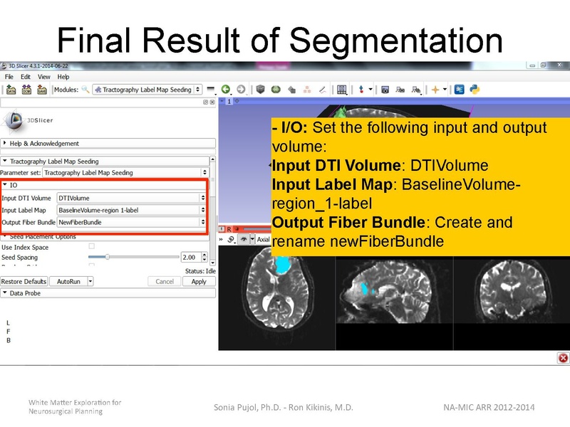 File:WhiteMatterExplorationTutorial SoniaPujol 2014.pdf