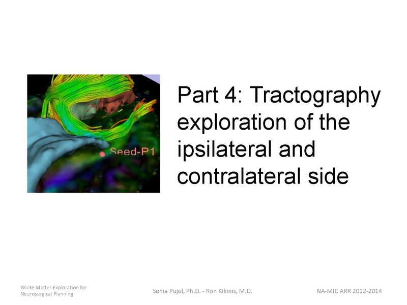 File:WhiteMatterExplorationTutorial SoniaPujol 2014.pdf