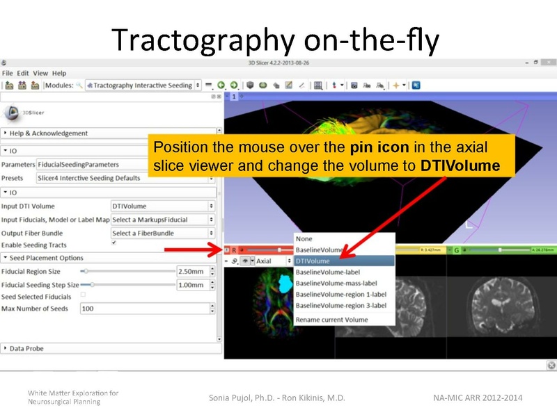 File:WhiteMatterExplorationTutorial SoniaPujol 2014.pdf