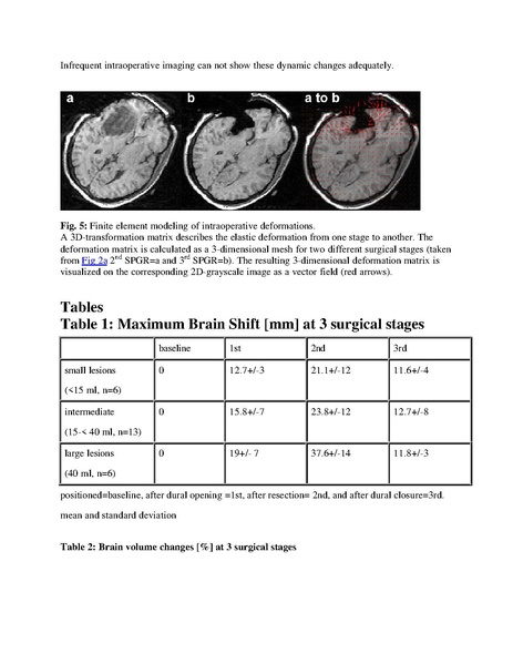 File:Nabavi-Neurosurgery2001.pdf