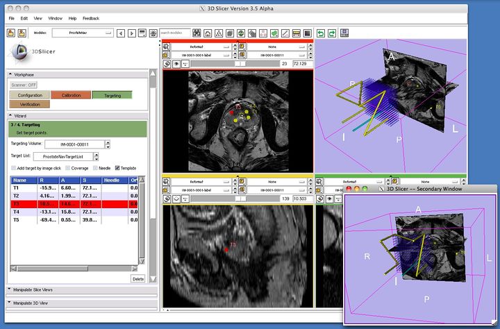 Modules:ProstateNav-Documentation-3.6 - Slicer Wiki
