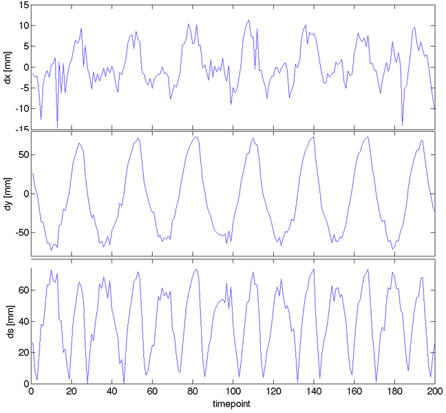 File:RegLib C46 Displacements.png