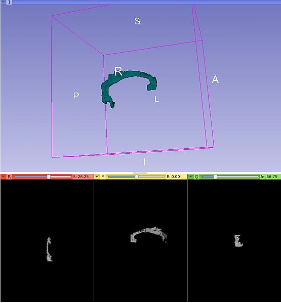 File:Slicer4-Mask-GUI-output.jpeg