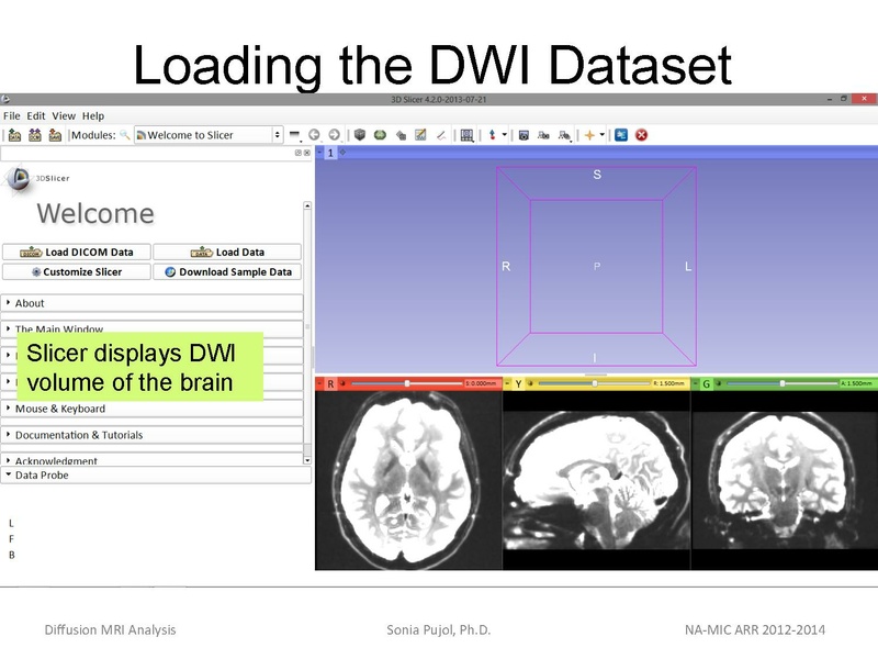 File:DiffusionMRIanalysis Tutorial SoniaPujol 2013.pdf