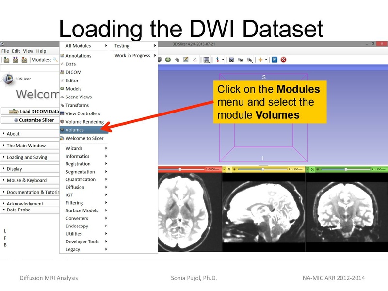 File:DiffusionMRIanalysis Tutorial SoniaPujol 2013.pdf
