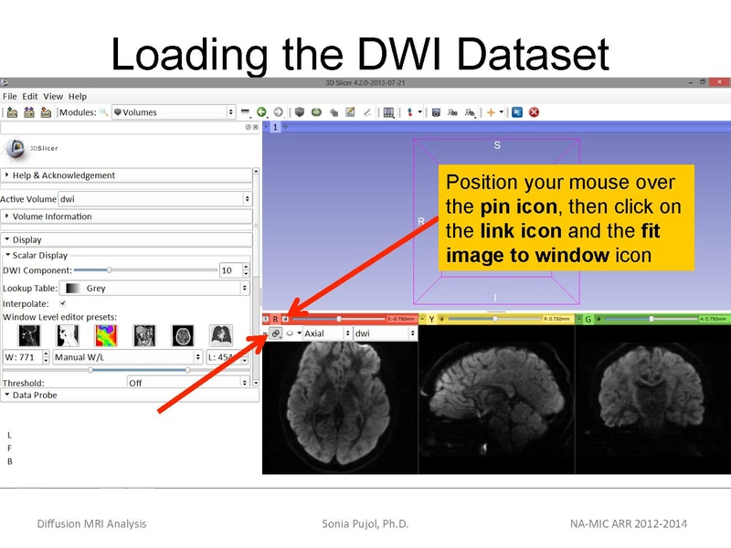 File:DiffusionMRIanalysis Tutorial SoniaPujol 2013.pdf