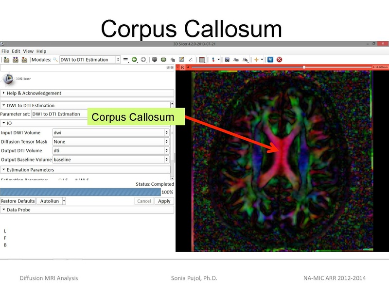 File:DiffusionMRIanalysis Tutorial SoniaPujol 2013.pdf