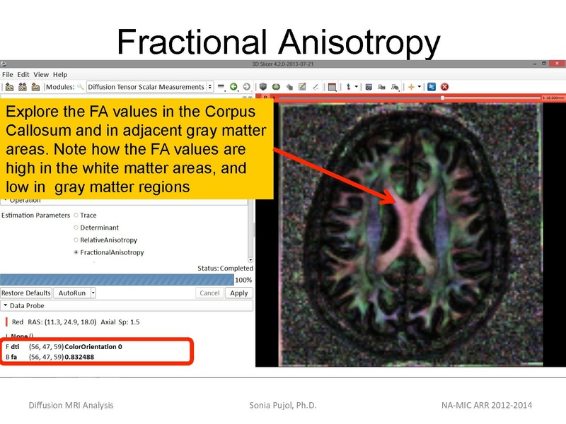 File:DiffusionMRIanalysis Tutorial SoniaPujol 2013.pdf