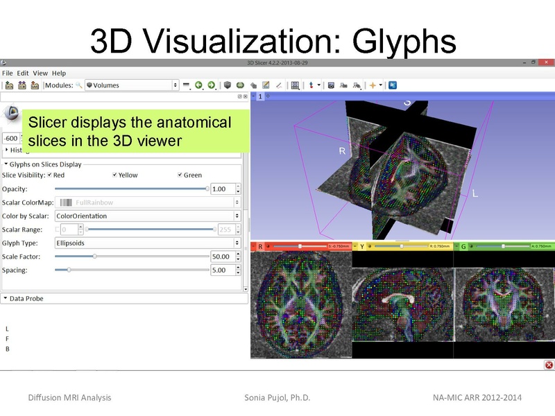 File:DiffusionMRIanalysis Tutorial SoniaPujol 2013.pdf